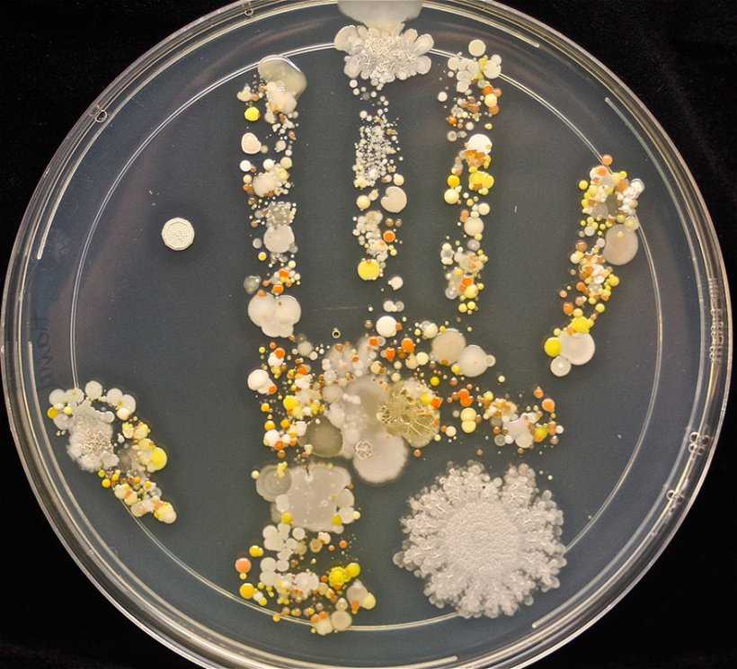 Микробы на отпечатке ладони 8-летнего мальчика после игры на улице