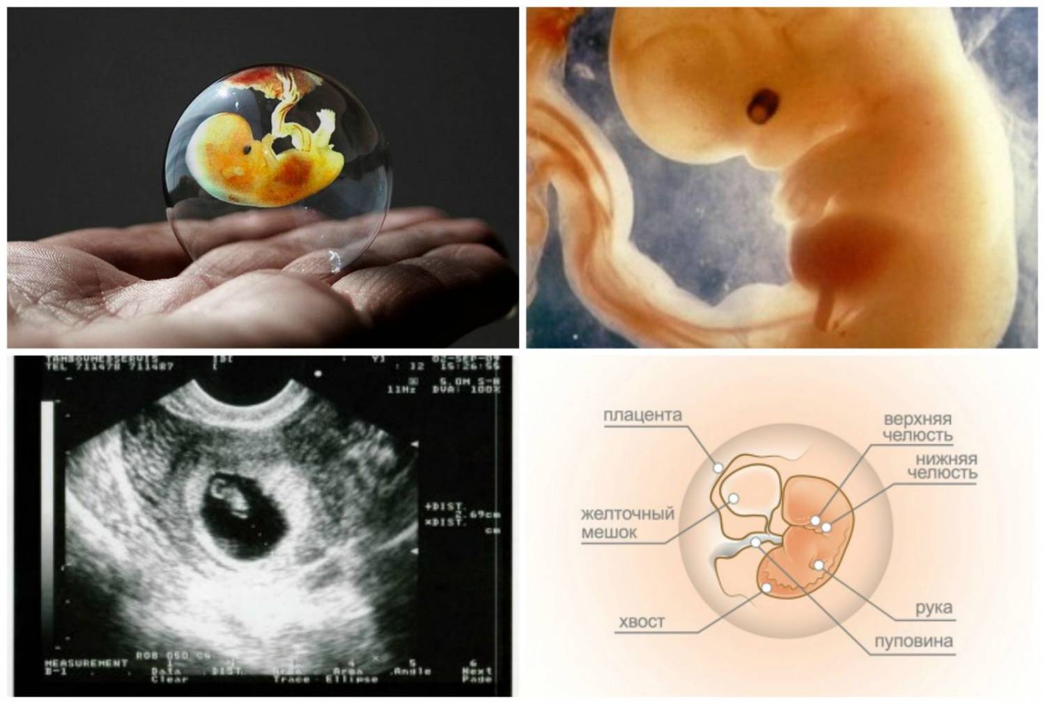 Когда визуализируется эмбрион на УЗИ?
