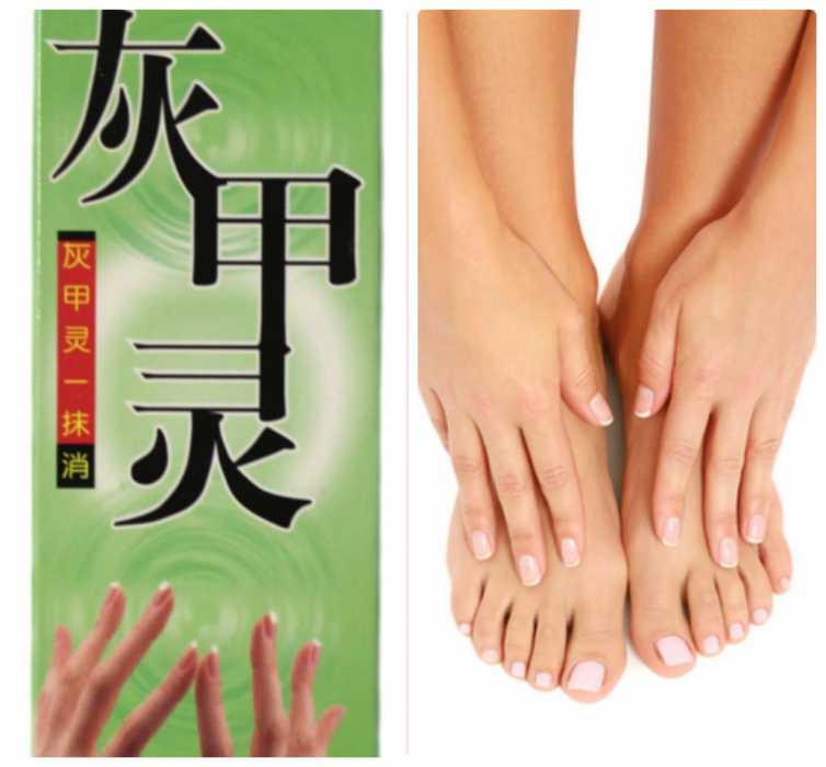 Восточная медицина от грибка на ногтях – антимикотическое средство Хуэйцзялин